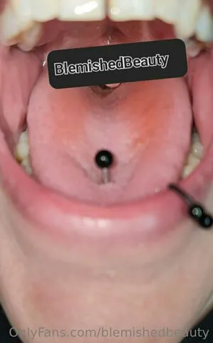 Blemishedbeauty OnlyFans Leaked Free Thumbnail Picture - #6lpSFnG8fP