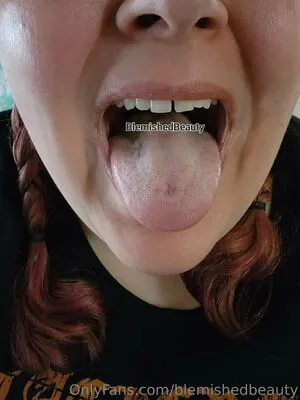 Blemishedbeauty OnlyFans Leaked Free Thumbnail Picture - #DrqMlVWUDM