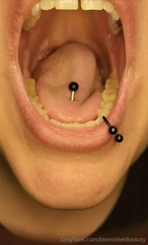 Blemishedbeauty OnlyFans Leaked Free Thumbnail Picture - #GxMnNAV6Cp