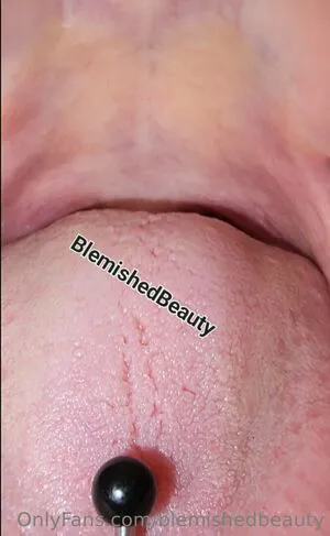 Blemishedbeauty OnlyFans Leaked Free Thumbnail Picture - #HxSS0zb4Wb