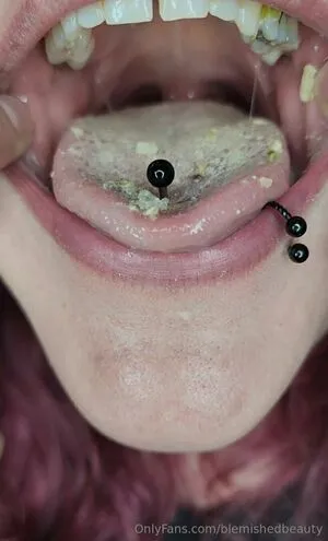 Blemishedbeauty OnlyFans Leaked Free Thumbnail Picture - #IcTGMEk8K7