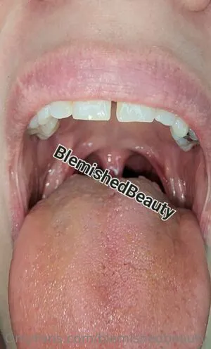Blemishedbeauty OnlyFans Leaked Free Thumbnail Picture - #JMBGmBWd1i