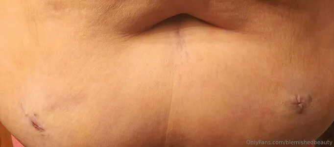 Blemishedbeauty OnlyFans Leaked Free Thumbnail Picture - #Pn5pbgKr4S