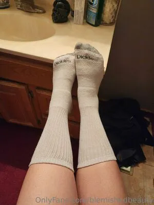 Blemishedbeauty OnlyFans Leaked Free Thumbnail Picture - #VRDRFddkYU