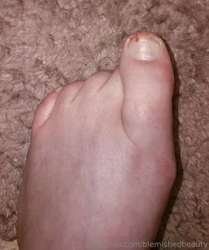 Blemishedbeauty OnlyFans Leaked Free Thumbnail Picture - #eQ3PYLZwN2