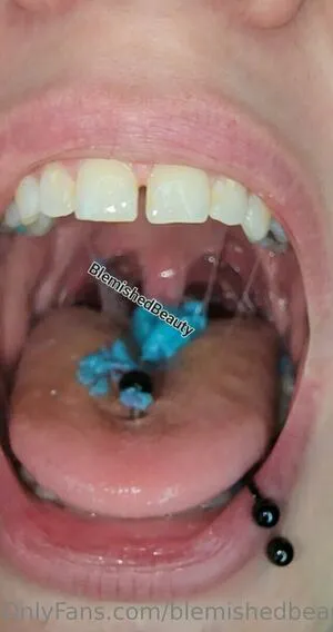 Blemishedbeauty OnlyFans Leaked Free Thumbnail Picture - #jpxySNAkxb
