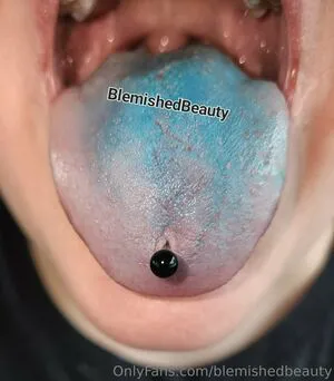 Blemishedbeauty OnlyFans Leaked Free Thumbnail Picture - #mgR9hPSod4