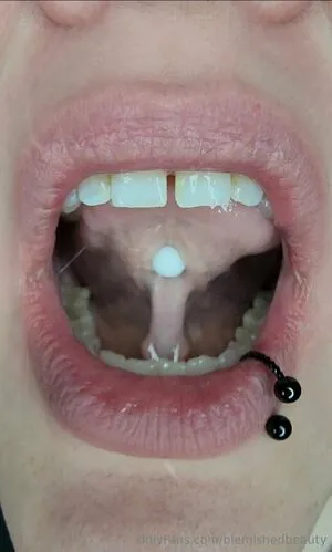 Blemishedbeauty OnlyFans Leaked Free Thumbnail Picture - #vcwAgBJqTQ