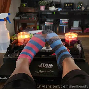 Blemishedbeauty OnlyFans Leaked Free Thumbnail Picture - #wPySgxnwOO