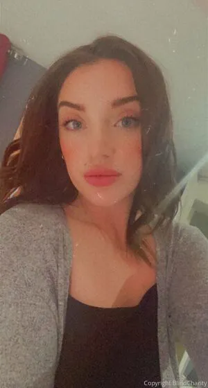 Blindcharity OnlyFans Leaked Free Thumbnail Picture - #4PLzyDq2ZE