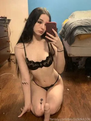 Bru1s3dkn33s OnlyFans Leaked Free Thumbnail Picture - #gnmzEMk7dF