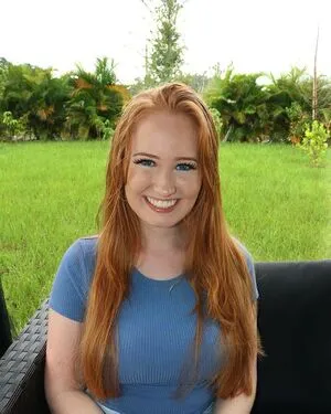 Burinski Twins OnlyFans Leaked Free Thumbnail Picture - #1Pgmg2472L