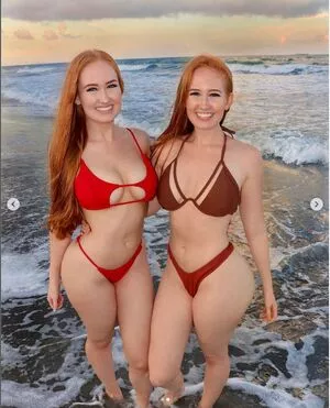 Burinski Twins OnlyFans Leaked Free Thumbnail Picture - #HlGsPuCZI7