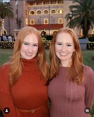 Burinski Twins OnlyFans Leaked Free Thumbnail Picture - #MX5e2LSGQN