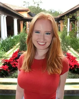 Burinski Twins OnlyFans Leaked Free Thumbnail Picture - #VdKPMsHppH