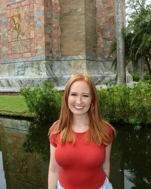 Burinski Twins OnlyFans Leaked Free Thumbnail Picture - #Ymcpghzofg