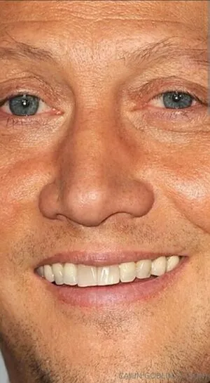 Cajungoblin OnlyFans Leaked Free Thumbnail Picture - #jks4oeXtD9