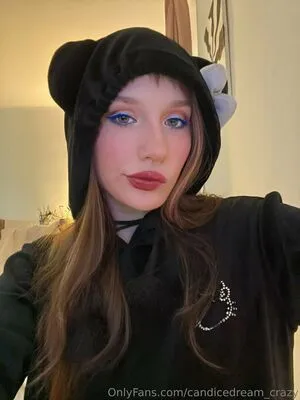 Candicedream Crazy OnlyFans Leaked Free Thumbnail Picture - #PBFbvlnyvK