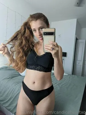 Candiceheartxo OnlyFans Leaked Free Thumbnail Picture - #HHpy8HgZD9
