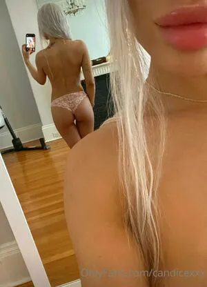 Candicexxx OnlyFans Leaked Free Thumbnail Picture - #N9hEBhKPSm