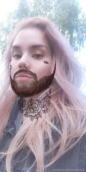 Candyabuse OnlyFans Leaked Free Thumbnail Picture - #hmKXNXBbeN