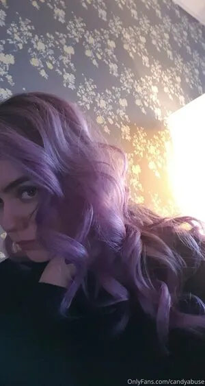 Candyabuse OnlyFans Leaked Free Thumbnail Picture - #wW3iO8tk1v