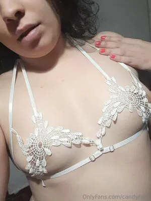 Candyfox1 OnlyFans Leaked Free Thumbnail Picture - #S3hYYHTKnm