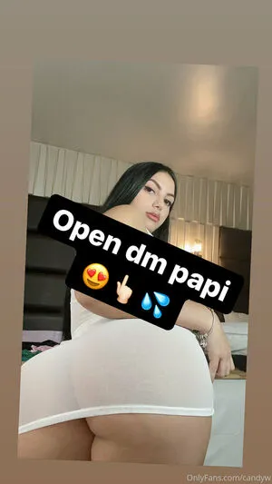 Candyw1 OnlyFans Leaked Free Thumbnail Picture - #E0qm1OZ2ZH