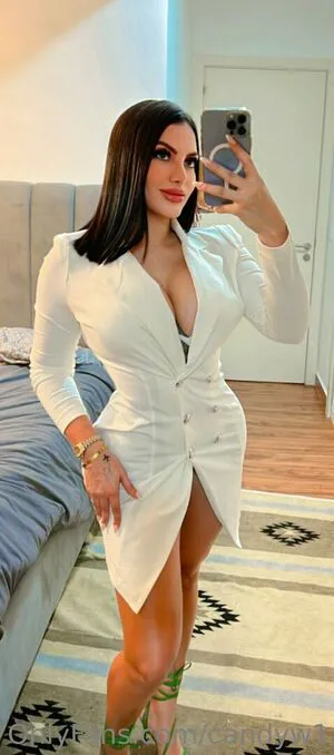 Candyw1 OnlyFans Leaked Free Thumbnail Picture - #IWuj4Y8tI9