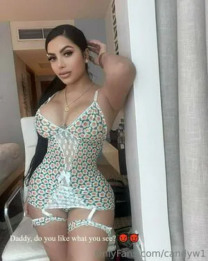 Candyw1 OnlyFans Leaked Free Thumbnail Picture - #R1nLs5vZei