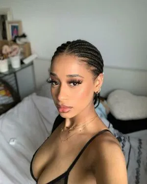 Capeverdian OnlyFans Leaked Free Thumbnail Picture - #tlEN8s5FsI