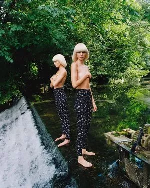 Cara Delevingne OnlyFans Leaked Free Thumbnail Picture - #z8TnMoT4oE