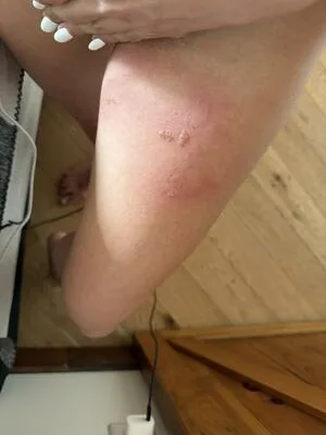 Carabeanz OnlyFans Leaked Free Thumbnail Picture - #lqNFmLiWSC