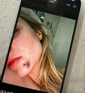 Cas Summer OnlyFans Leaked Free Thumbnail Picture - #nTXjsUDBs3