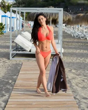 Casey Batchelor OnlyFans Leaked Free Thumbnail Picture - #AUM6WU1wxV
