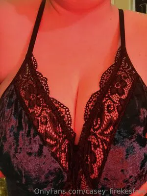 Casey Firekesfree OnlyFans Leaked Free Thumbnail Picture - #VmCTsdNaxL