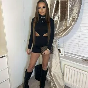 Casey Turnbull OnlyFans Leaked Free Thumbnail Picture - #hZrKQRXaFM
