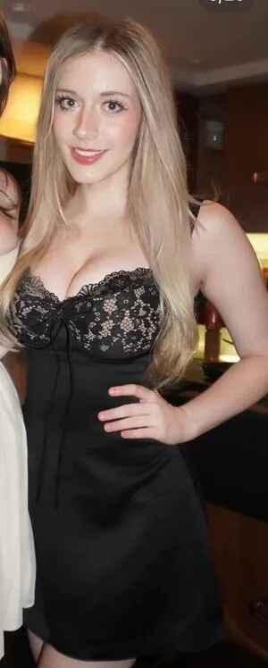 Celebrity Guilty Pleasures Underrated Women OnlyFans Leaked Free Thumbnail Picture - #iQgbvaKgTX