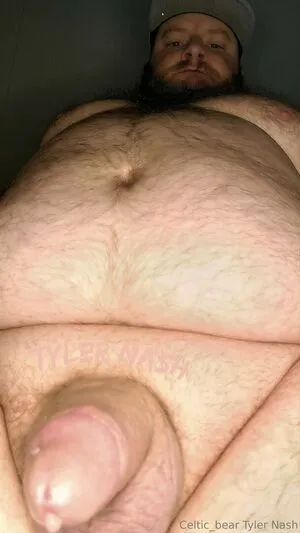 Celtic Bear OnlyFans Leaked Free Thumbnail Picture - #yIlS7Wlhsr
