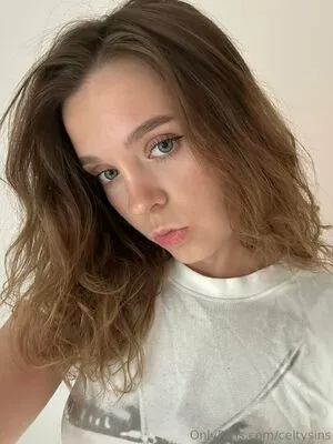 Celtysins OnlyFans Leaked Free Thumbnail Picture - #Ludxk1QyMi