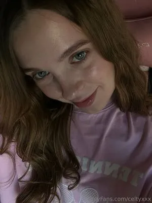 Celtysins OnlyFans Leaked Free Thumbnail Picture - #Mlb8GuoI4W
