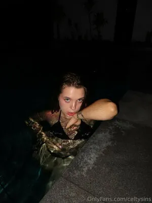Celtysins OnlyFans Leaked Free Thumbnail Picture - #wsYaZJbjfV