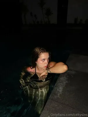 Celtysins OnlyFans Leaked Free Thumbnail Picture - #zRkrmEaxwY