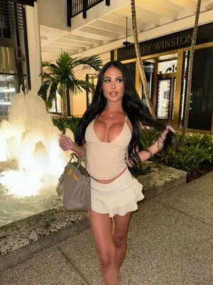 Chels Steinberg OnlyFans Leaked Free Thumbnail Picture - #7PeaLyUI0a