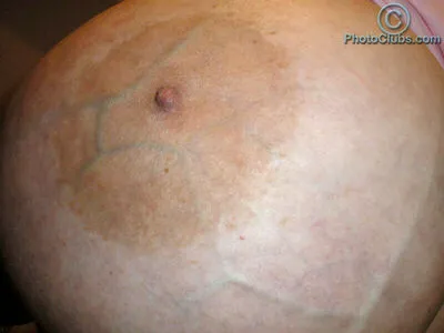 Chelsea Charms OnlyFans Leaked Free Thumbnail Picture - #BsJXWFfPgi