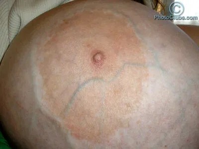 Chelsea Charms OnlyFans Leaked Free Thumbnail Picture - #RXbOdP5Ley