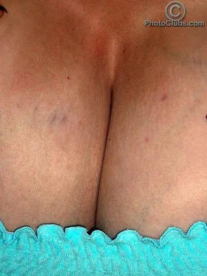 Chelsea Charms OnlyFans Leaked Free Thumbnail Picture - #fGeUzl6D0T