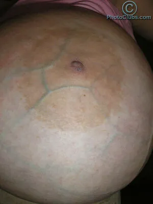 Chelsea Charms OnlyFans Leaked Free Thumbnail Picture - #pv85vEYQyF