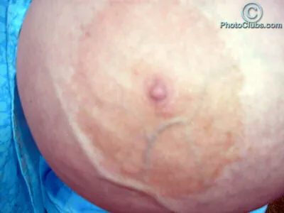 Chelsea Charms OnlyFans Leaked Free Thumbnail Picture - #vbH7rovfep