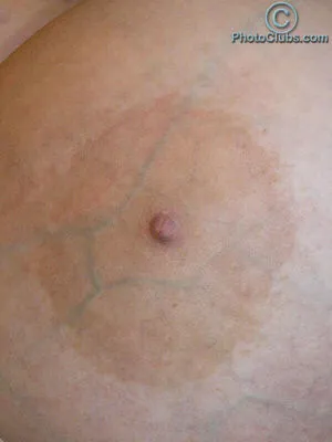 Chelsea Charms OnlyFans Leaked Free Thumbnail Picture - #zgqz9VHmOP